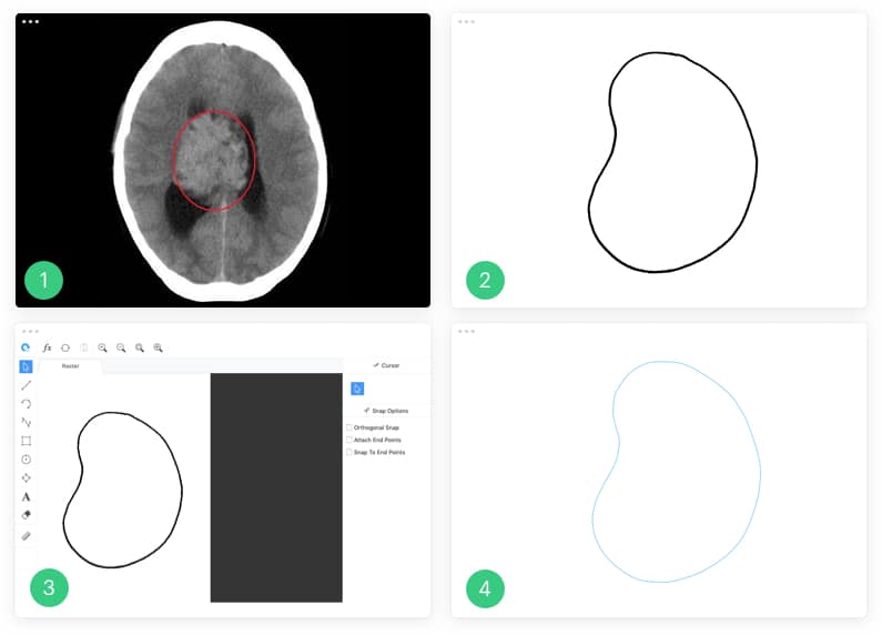 The process of converting a tumour profile to vector CAD/CAM format